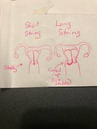 They can cut your iud strings to a better length for you. Why You Actually Want Longer Iud Strings Album On Imgur