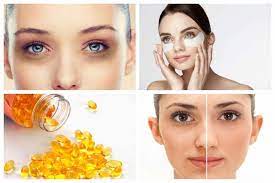 What Vitamin Deficiency Causes Dark Circles Under Eyes Dark Circles Under Eyes Dark Eye Circles Dark Circles Around Eyes