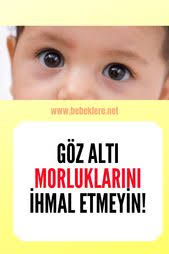 Bebek Goz Alti Morlugu Bebek Bebek Sagligi Gozler