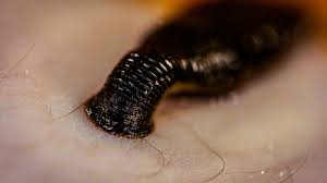 However, canine scabies and feline scabies are not caused by the same type of mite that triggers human scabies. Read About Symbiosis Science For Grades 6 8 Printable