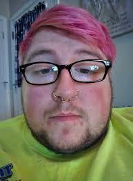 Two Parallel bite type marks You can see some serration marks but they are  not spectacular