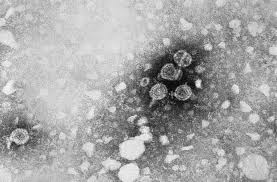 Anda dapat merawat ikterus dengan pengobatan medis, tetapi anda mungkin juga ingin mempertimbangkan untuk mencoba pengobatan alami belum teruji yang dapat. Hepatitis B Wikipedia Bahasa Melayu Ensiklopedia Bebas