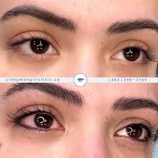 Our services can help you achieve your. Cinnamon Girl Clinic Cosmetic Paramedical Tattooing