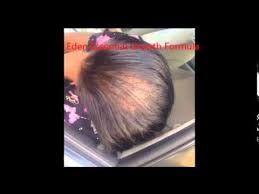 How To Grow Long Hair Edges And Bald Spots Back Super Fast 1 3 Inches In 30 Days Grow Long Hair Castor Oil For Hair Growth Castor Oil For Hair