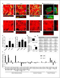 Maybe you would like to learn more about one of these? Macrophage Dependent Trafficking And Remodeling Of The Basement Membrane Interstitial Matrix Interface Biorxiv