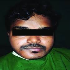 Exemplar histology of the commonest malignant odontogenic tumours....