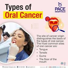 Image result for gum cancer symptoms
