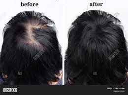 The vast majority of liquid concealers are sprays, which you apply just like you would a normal hair spray. Female Hair Bald Patch Image Photo Free Trial Bigstock