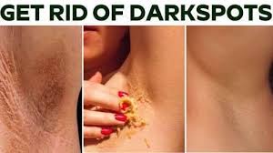 Pin On Remove Dark Spots