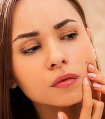 Huile De Ricin 10 Utilisations Et Bienfaits Huile De Ricin Ricin Huile De Ricin Cheveux