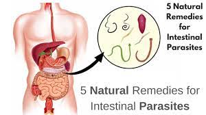 How To Get Rid Of Tapeworms Home Remedy 5 Natural Remedies For Intestinal Parasites Youtube