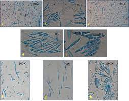 Identification And Characterization Of Fusarium Sp Using Its And Rapd Causing Fusarium Wilt Of Tomato Isolated From Assam North East India Sciencedirect