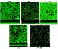 Over the time it has been ranked as high as 2 253 299 in the world. Toxins Free Full Text The Streptococcus Pneumoniae Yefm Yoeb And Relbe Toxin Antitoxin Operons Participate In Oxidative Stress And Biofilm Formation