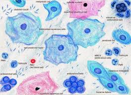 Normal Cells Of The Cervix Consist Basically Of Squamous Glandular And Metaplastic Epithelia Medical Laboratory Medical Technology Medical Laboratory Science