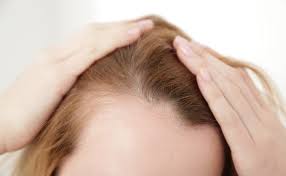 Once you are stable they will all startup again. Thyroid And Hair Loss Thyroid And Hair Loss Hormones