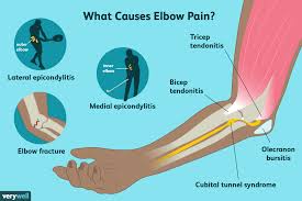 Golfer's elbow symptoms are very similar to a condition called cubital tunnel syndrome. Elbow Pain Causes Treatment And When To See A Doctor