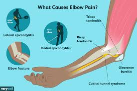 Symptoms of forearm tendinitis include pain along the forearm, tenderness, and stiffness. Elbow Pain Causes Treatment And When To See A Doctor