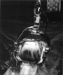 Image result for Pallidotomy