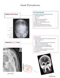 Image result for Skull XRay