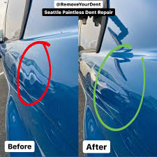 For more information, just call our friendly helpline on 0800 145 5118, or alternatively use our enquiry form to locate your nearest dent removal specialist. Seattle Mobile Paintless Dent Repair Remove Your Dent