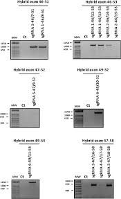 Download printable animal coloring sheets free at animals town. Crispr Induced Deletion With Sacas9 Restores Dystrophin Expression In Dystrophic Models In Vitro And In Vivo Molecular Therapy
