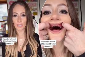 I am not sure how long it would take to get used to it. Mom Pops Dentures On Tiktok And Becomes Viral To Reduce Stigma New York Latest News