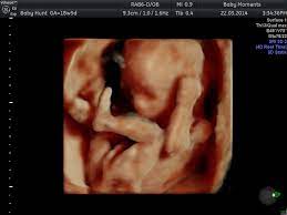 15 Mins Mini Wellbeing Scan - Baby Moments 3D 4D ultrasound Scan Centre  Oxfordshire