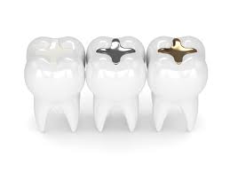 Kann ich dann nicht zurück nach deutschland? Moglichkeiten Fur Zahnersatz Donau Dental