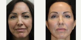 Luis Soro, DO, Dermatologic Surgeon, Board Certified in Dermatology