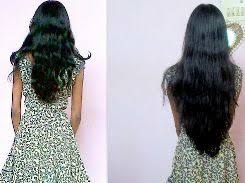 Biotin Pills For Hair Growth Side Effects Biotin Hair Growth Results Reviews Before And After Pictures Gold Pills Biotin Side Effects One Year Hair Growth Hair Growth Pictures Biotin Hair Growth