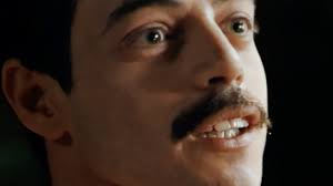 Freddie mercury's teeth are in what we call anterior over jet or call ii malocclusion of teeth by angle. The Man Behind Freddie Mercury S Teeth In Bohemian Rhapsody The New York Times