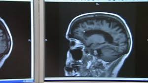 It was first identified in december 2019 in wuhan,. What Is Long Haul Covid 19 Doctor Describes Patients Crushing Headaches Cognitive Symptoms After Recovery Abc7 San Francisco
