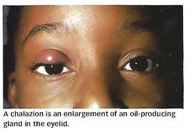 Image result for Blepharis affinis