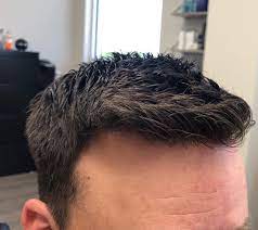 Find hair salon near me with good hair stylist best haircut salons near me that open on sunday locate the top rated haircut salons nearby here in hairsalonsnearme.me directory. Changing Demographics Of Men Having Non Surgical Hair Replacement Professional Hair Design