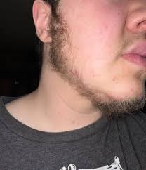 Beard coverings offered if spd techs have to cut beards?