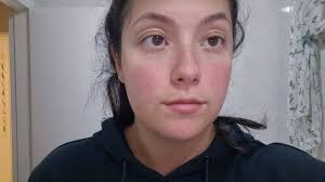 What is fibromyalgia and how to deal with its symptoms?