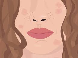 Eczema is an allergic skin condition that's also called atopic dermatitis. How To Treat Eczema Especially When It S Severe Glamour