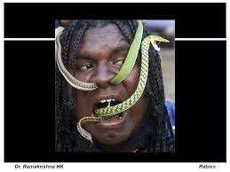 Dr. Ramakrishna HK Rabies