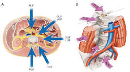 OLIF Spine Surgery - Modern Orthopedic Spine Specialists