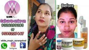 al-Harman skin cream facewash review by customer.