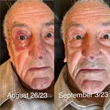 Collagen supplements for joint health and skin