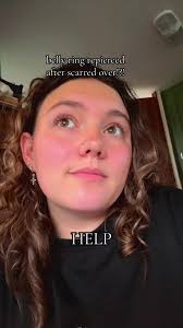 Repiercing My Belly Button: A Personal Journey