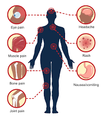 Image result for Dengue