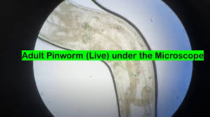 Image result for Pinworm Test