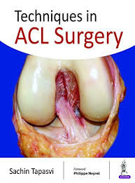 Maybe you would like to learn more about one of these? Techniques In Acl Surgery English Edition Ebook Tapasvi Sachin Amazon De Kindle Shop