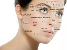 Best Dermatologist Near Me Organic Skin Care Natural Anti Aging Skin Care Skin Care Acne
