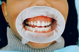 Read to find out more about caring for your teeth and gums. What Do Healthy Gums Look Like West Keller Dental