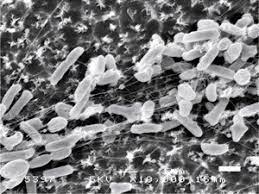 ペットボトルむしゃむしゃ 堺で発見の細菌 世界救う ｇ２０大阪サミット プラごみ危機 朝日新聞デジタル 堺 世界 ペットボトル