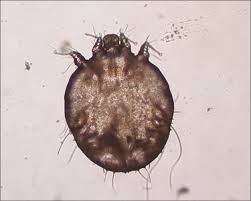 Image result for Sarcoptes scabiei