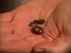 Like many other ailments, a poor diet is the leading cause of kidney stone formation. Kidney Stones Michigan Medicine
